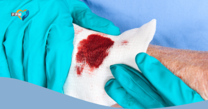 Pflegeperson mit Handschuhen versorgt chronische Wunde einer Pflegepatientin