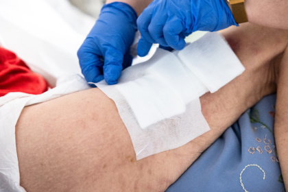 Im Zentrum des Bildes wird der Arm eines Senioren mit großen Wundverbänden behandelt. Ein Pfleger mit blauen Handschuhen trägt die weißen Wundverbände auf. Der Pfleger trägt eine Armbanduhr. Nur der Arm des Seniors und die Hände des Pflegers sind auf dem Bild zu sehen.